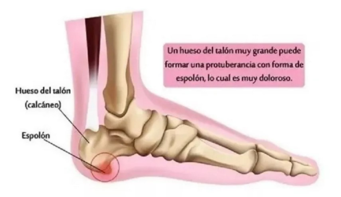 Plantillas Ortopédicas Taloneras Silicon